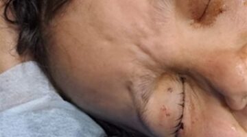 أم تتسبب في إصابة 3 من أبنائها بوضع حناء بدلًا من الكحل في أعينهم بكفر الشيخ